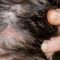 Understanding Medical Conditions and Female Hair Loss: What You Need to Know