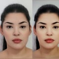 Understanding Asymmetry in Aesthetic Surgery