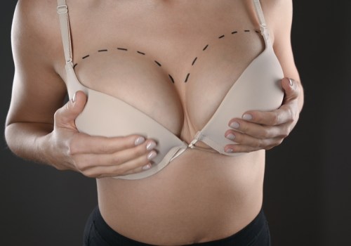 Breast Augmentation: Enhancing Your Beauty and Confidence