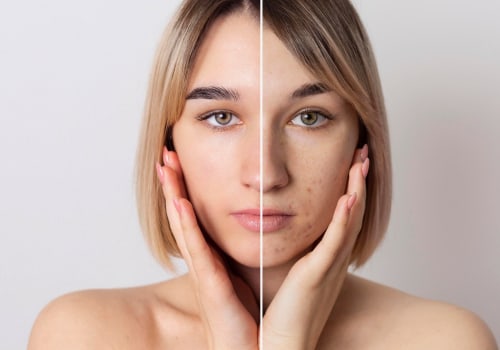 Is aesthetic surgery and plastic surgery the same?