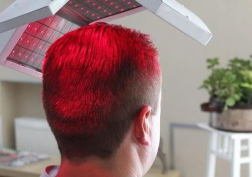 Understanding Low-Level Laser Therapy (LLLT) for Hair Loss: A Comprehensive Guide