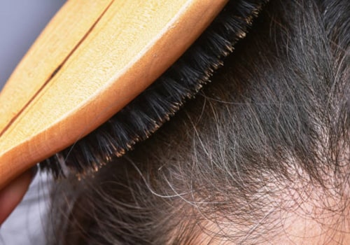 Understanding the Link Between Stress and Hair Loss