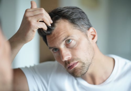 Understanding Hormonal Changes and Male Pattern Baldness